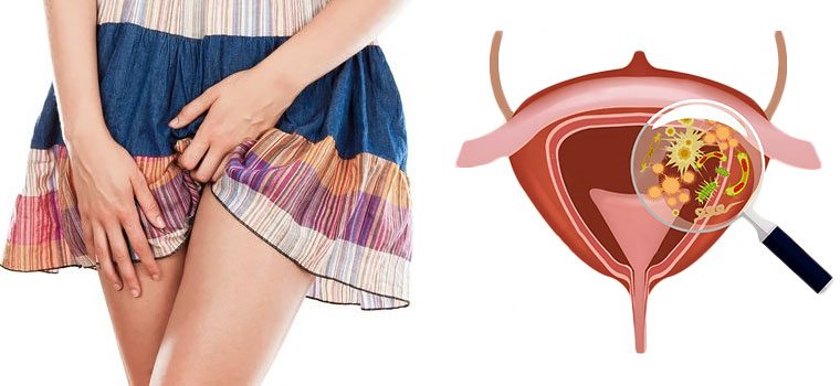 [Валентина Скороход] Молочница. Цистит (2020)_0.jpg